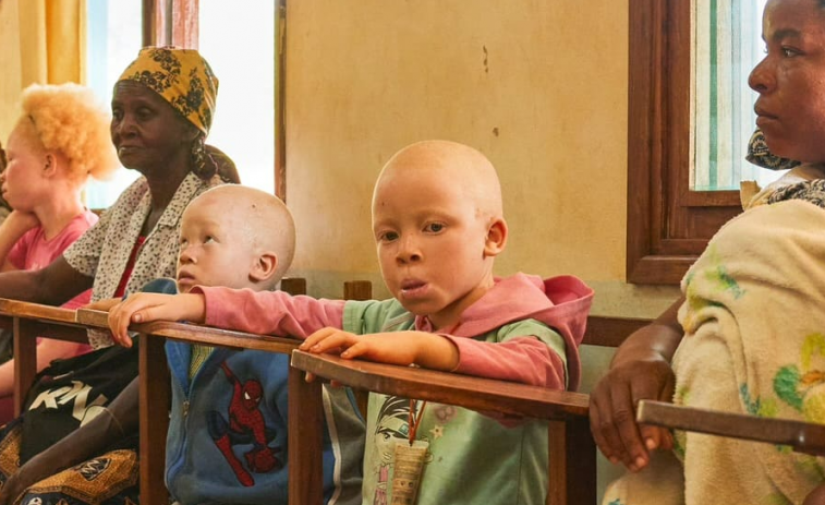 Universitarios gallegos ayudan sanitariamente a las personas albinas de Mozambique